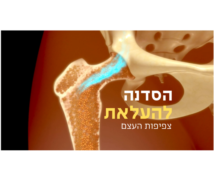 סדנה להעלאת צפיפות העצם לנשים עם אוסטיאופורוזיס