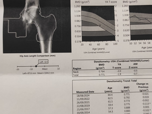  אוסטיאופורוזיס בגיל המעבר:                                                                   המדריך המלא לטיפול טבעי באמצעות אימוני כוח.