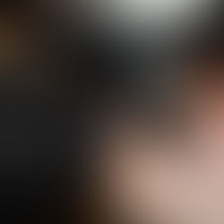 Microneedling in Nederland – Complete Gids voor Huidverjonging