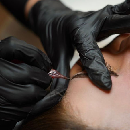 Microneedling in Nederland – Complete Gids voor Huidverjonging