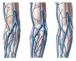 NCS - MORFOLOGIA - 23/02/23 -SP 1.1 