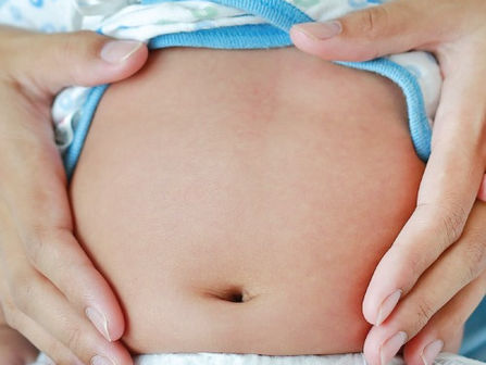 Intolerancia a la lactosa vrs APLV