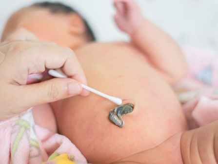 Cuidados del recién nacido