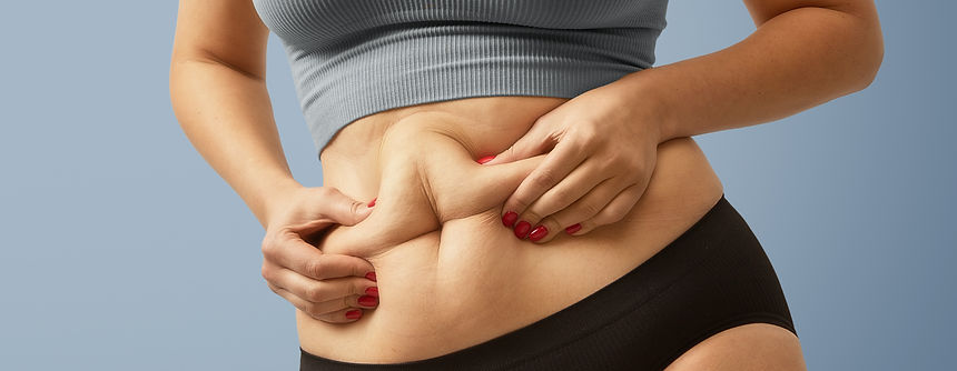 woman-body-fat-belly-obese-woman-hands-holding-excessive-tummy-fat-change-diet-lifestyle-c