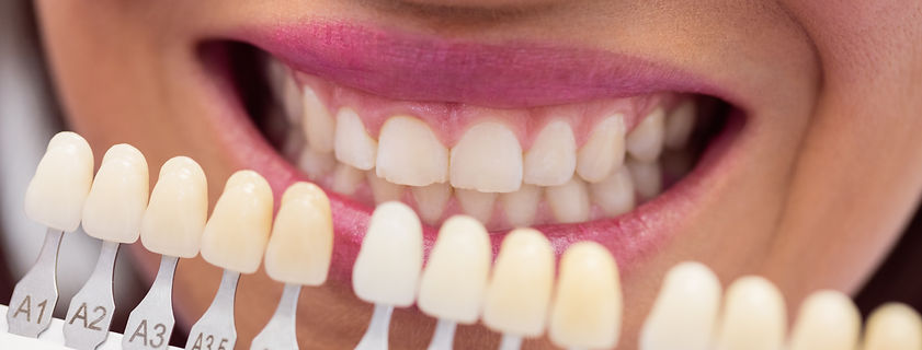 dentist-examining-female-patient-with-teeth-shades.jpg