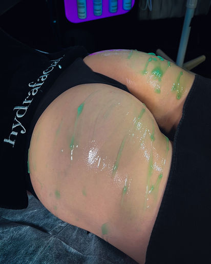 Med spa in Houston, Botox, lip filler, eyebrows, dermaplaning, skin care in Houston, permanent tattoos, freckle tattoos, eyebrow waxing, body contouring, hydra facial, facials in Houston, scar treatment