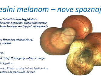 Uvealni melanom - nove spoznaje