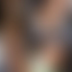 Neuroendocrine cancer diffuse non-Hodgkin’s lymphoma