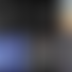 Astrocytoma Brain Cancer Treatment for Kid