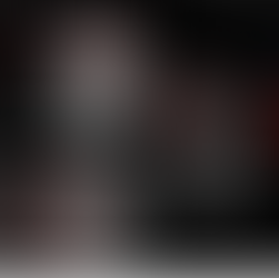 2.5cm Shrinkage in 3 Months With Combined Cancer Treatment for GBM 在3个月内采用综合癌症治疗后，脑胶质母细胞瘤缩小了2.5厘米。