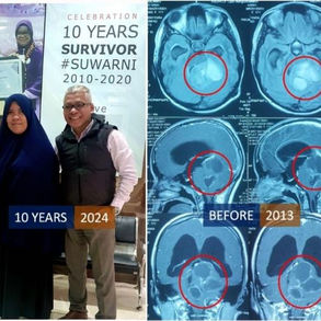 The Unyielding Spirit: A Journey Through Treatment for Brainstem Cancer 不屈的精神：脑干癌治疗之旅