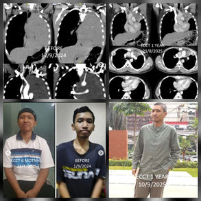 Germ Cell Tumor