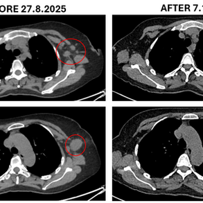 Effective Cancer Treatment