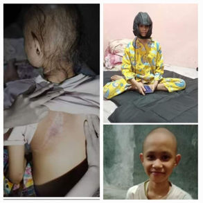 Nazwa's Battle Against Rare Rhabdomyosarcoma Soft Tissue Tumour 纳兹瓦与罕见的横纹肌肉肉瘤的搏斗