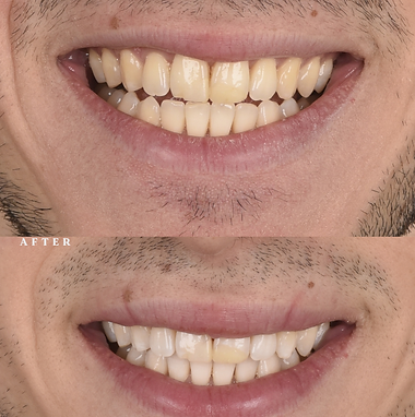 before (1).png