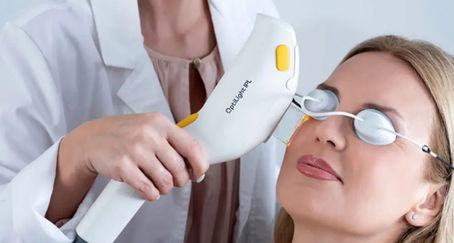 Effective Dry Eye Treatments for Ultimate Relief