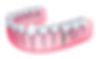 Dental Implants in Pembroke Pines