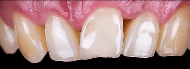 3ED8BBAD-77DB-44C3-BB06-D82D382AB554before.png
