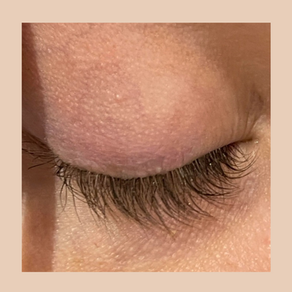 Lashes growing in different directions