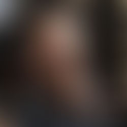 ¿Cómo evitar la piel seca debajo de tu barba y bigote?