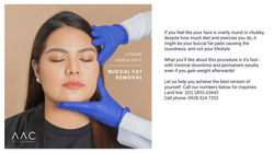 Buccal fat removal
