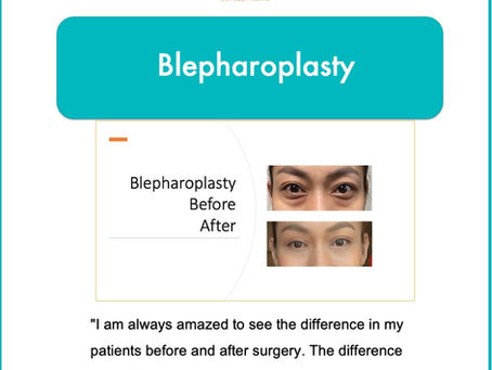 Why should Blepharoplasty Surgery only be done by an Ophthalmologist?