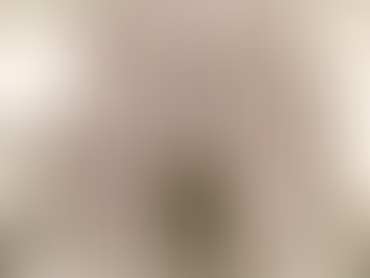 Patologización en la prevención: ensañamiento preventivo.