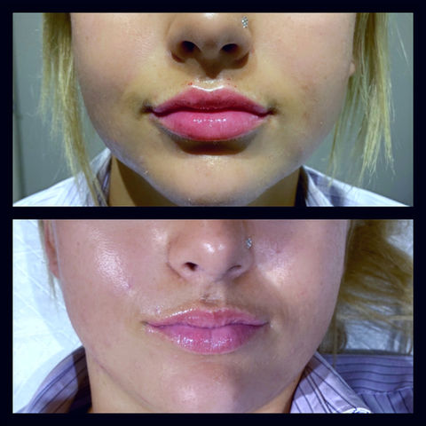 Steph 
"I absolutely LOVE my lips! 
 I am obsessed! Thank you 
 so much."