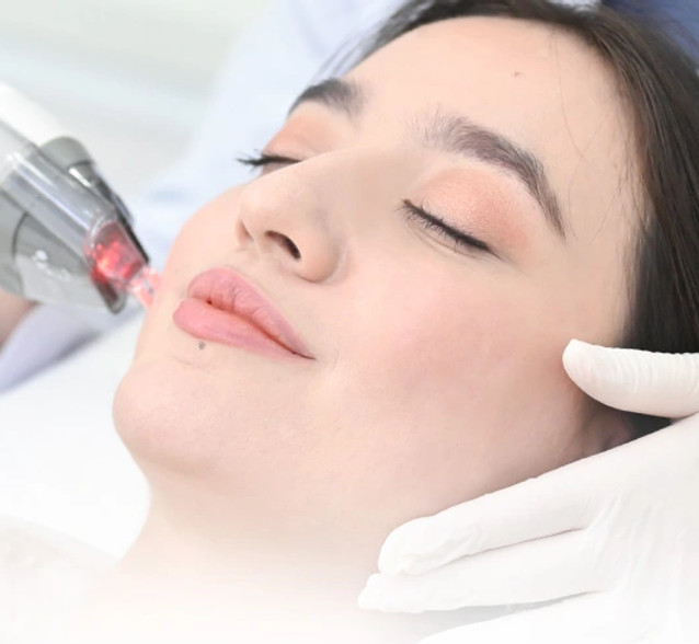 Acne scar therapy in Fort Lauderdale