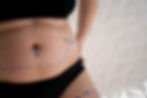 Weight loss in South Florica