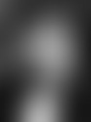 The Infamous Disease And The Famous