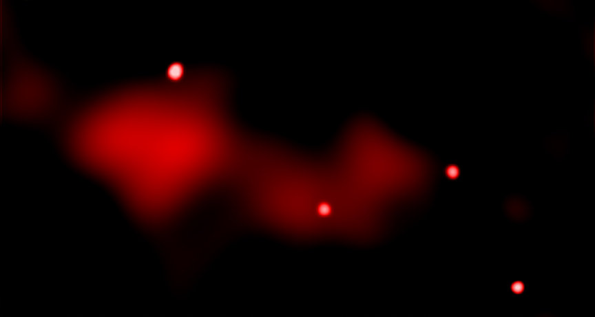 bhfeedback_xray.jpeg