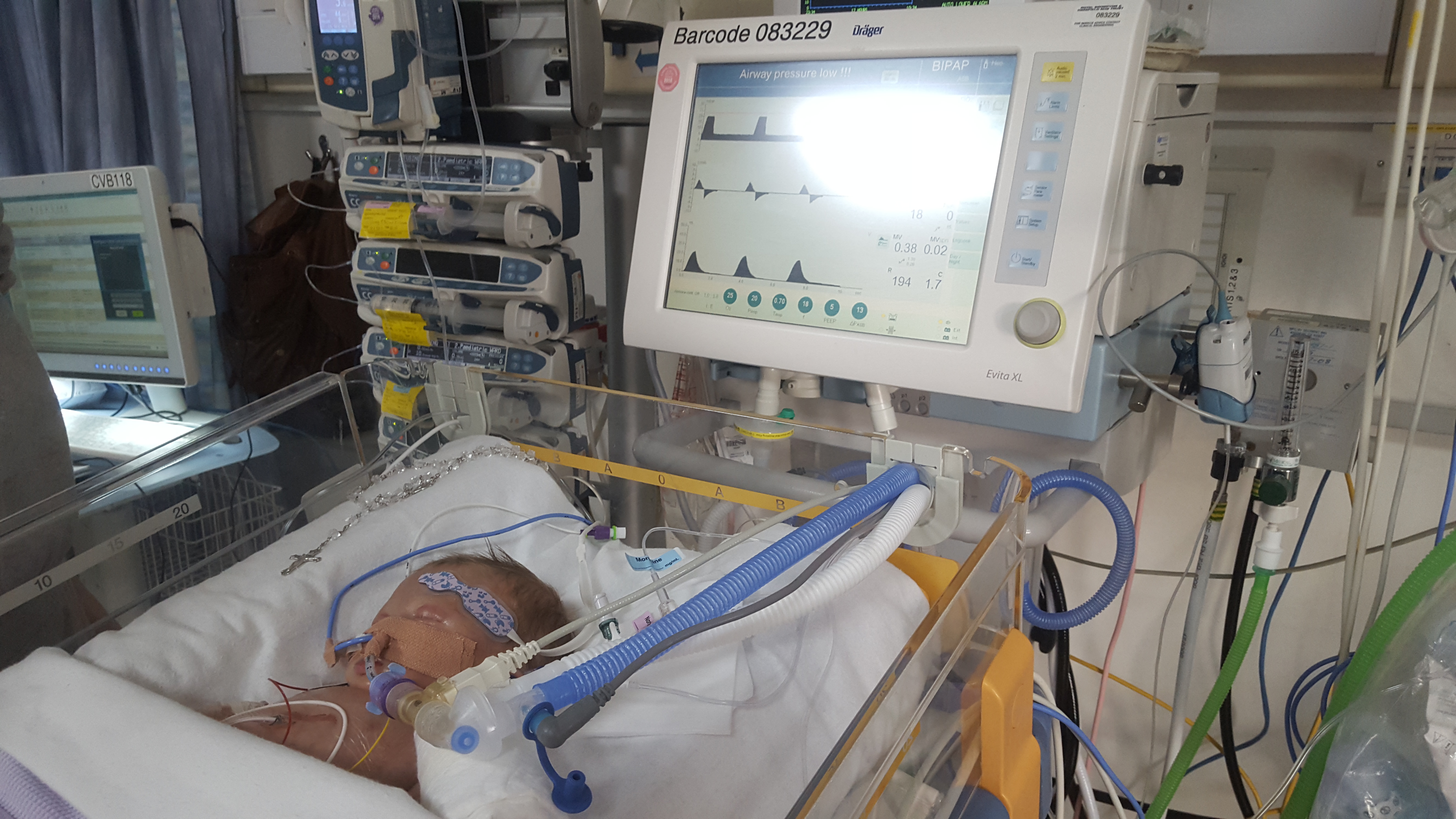 Sonny's real fight for life after surger