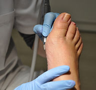 podologue sèvres, podologue 92, semelles orthopédiques, pédicure, soin