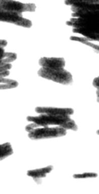 Small Strokes