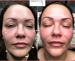 Facial profile balancing