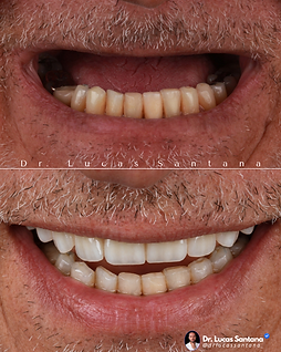 Dr. Lucas Santana _ cromg44648 (1).png