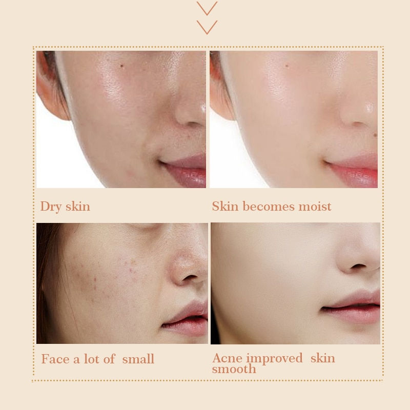 Thumbnail: Crema Anti Rughe