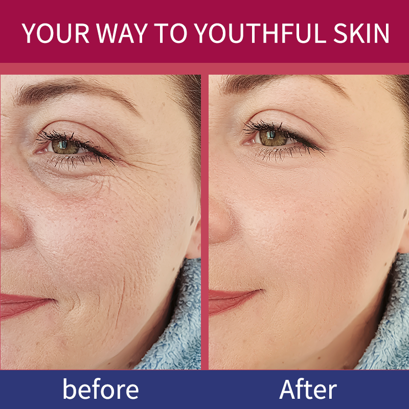 Thumbnail: Korean Bio Collagen Anti-aging Face Mask Hyaluronic Acid Deep Hydrating Moisturi