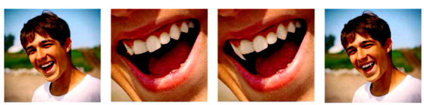 dientes.jpg