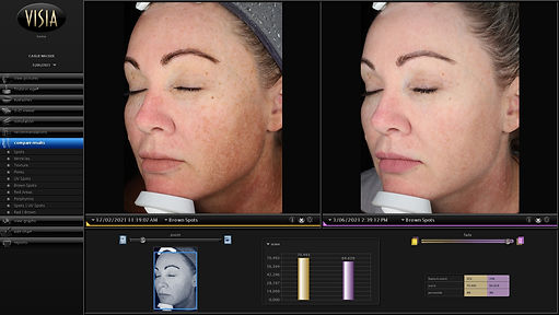 Limelight - CWacker polorised.JPG