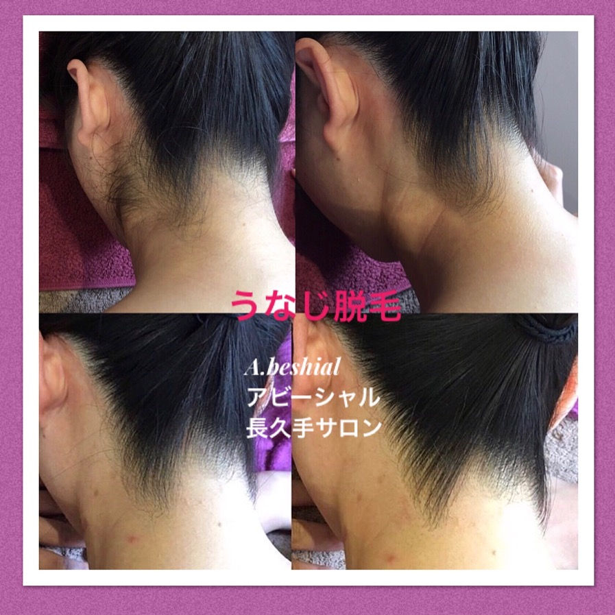 理想のうなじとは