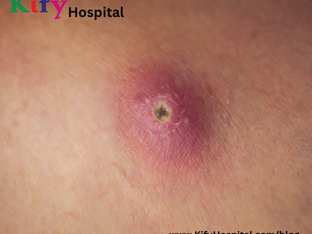 సెగ గడ్డలు, చీము గడ్డలు, వేడి గడ్డలు తో బాధపడుతున్నారా అయితే వీటిని ట్రై చేస్తే వెంటనే పోతాయి