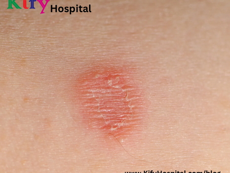 తామర మచ్చలు పోవాలంటే ఏం చేయాలి?