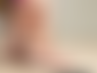 Swollen Legs After Travel