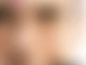 కామెర్లు