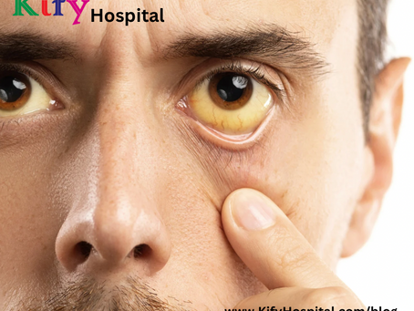 కామెర్లు