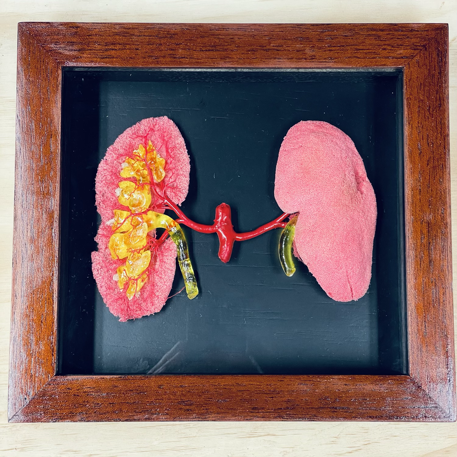 Corrosion cast pig kidneys