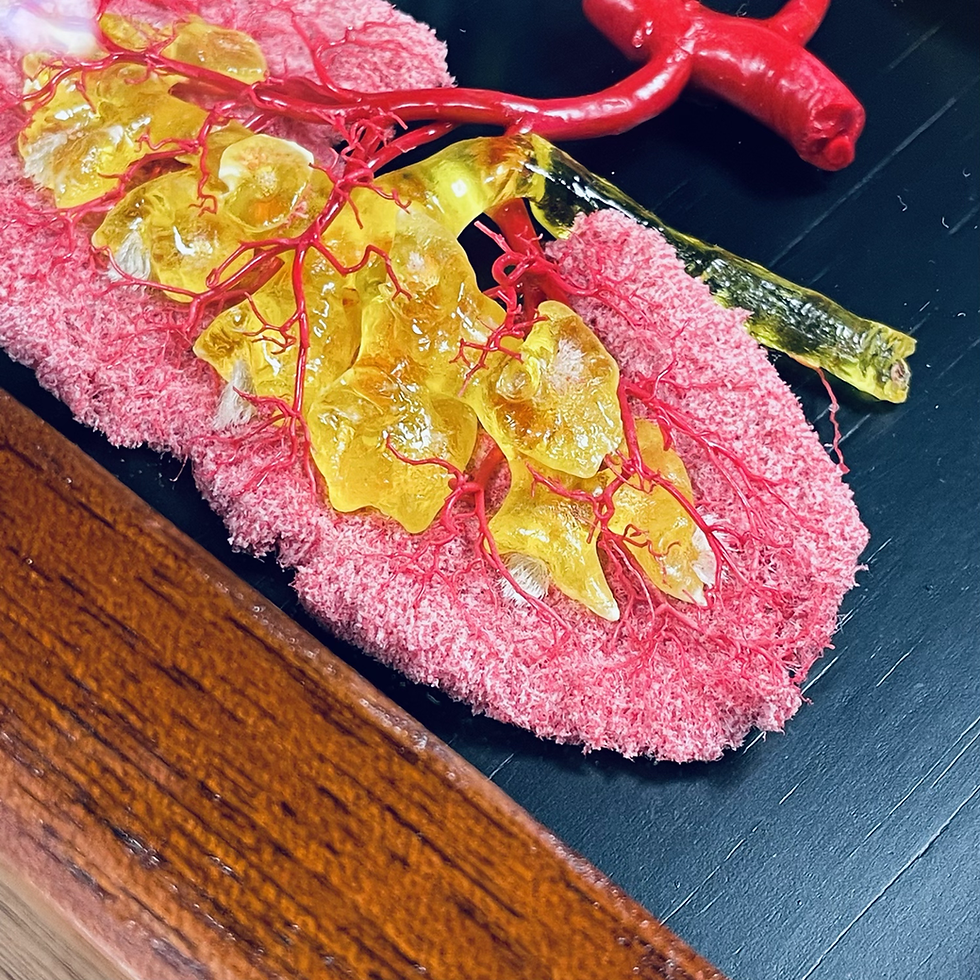 Thumbnail: Corrosion cast pig kidneys 
