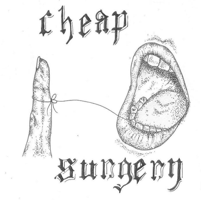 Cheap Surgery